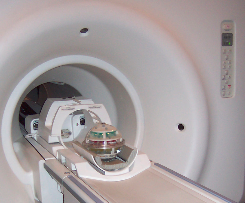 MRI scan for Hypoxic ischemic encephalopathy