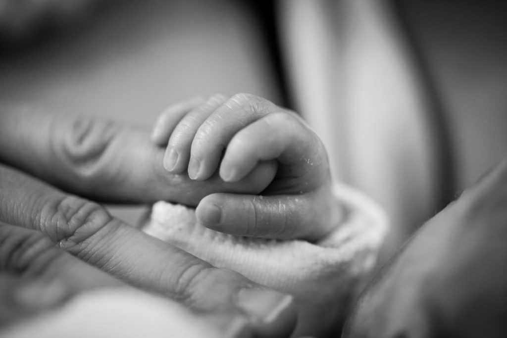 baby with a brachial plexus birth injury holding parents' finger