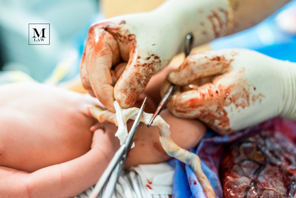 doctors cutting umbilical cord and removing placenta