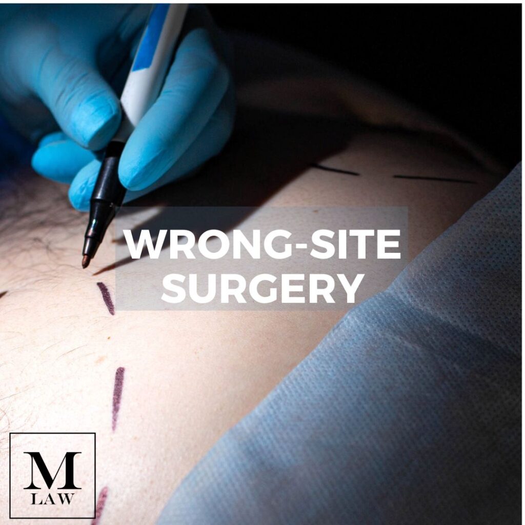 Wrong-site surgery
