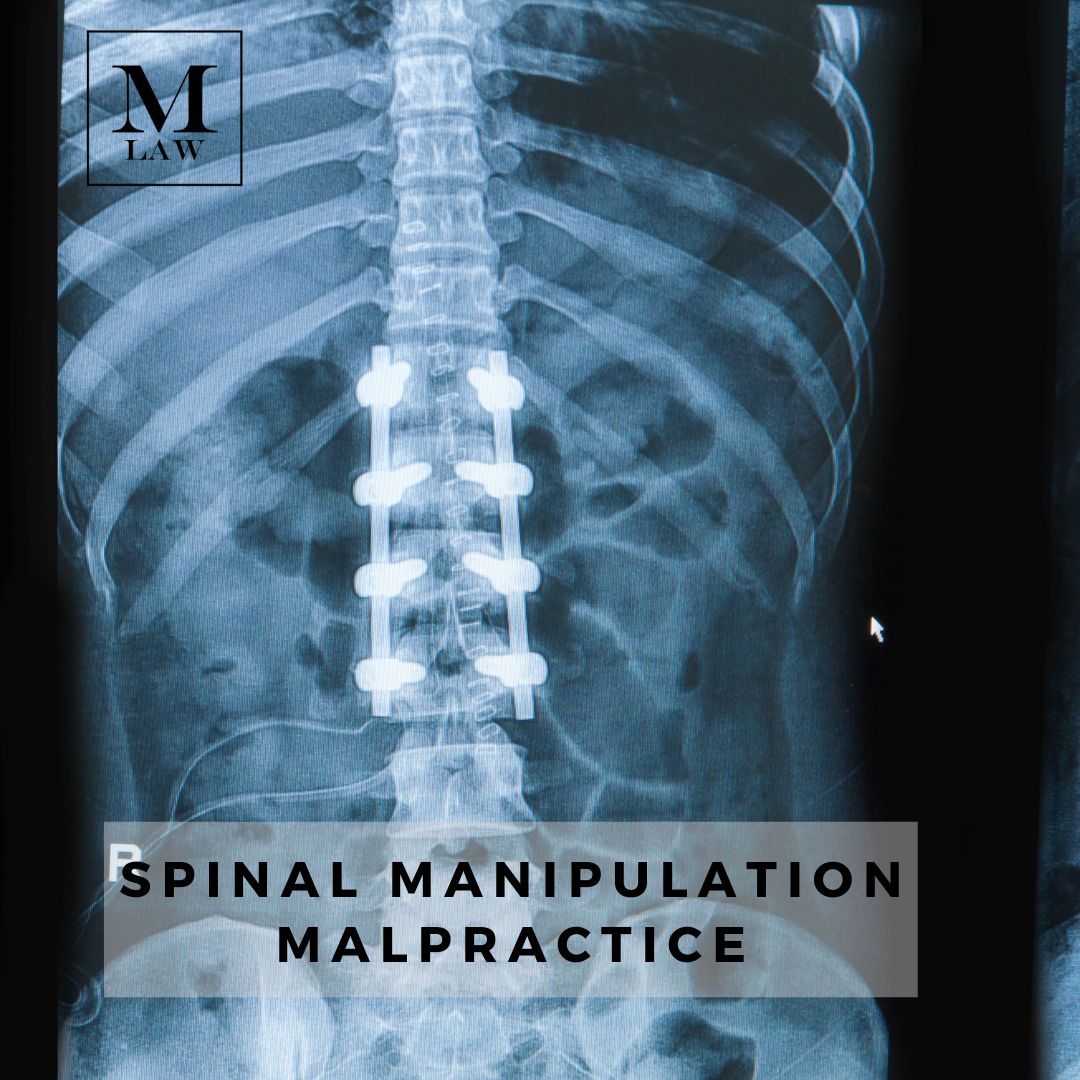 x-ray of a spinal manipulation injury requiring multiple spinal implants