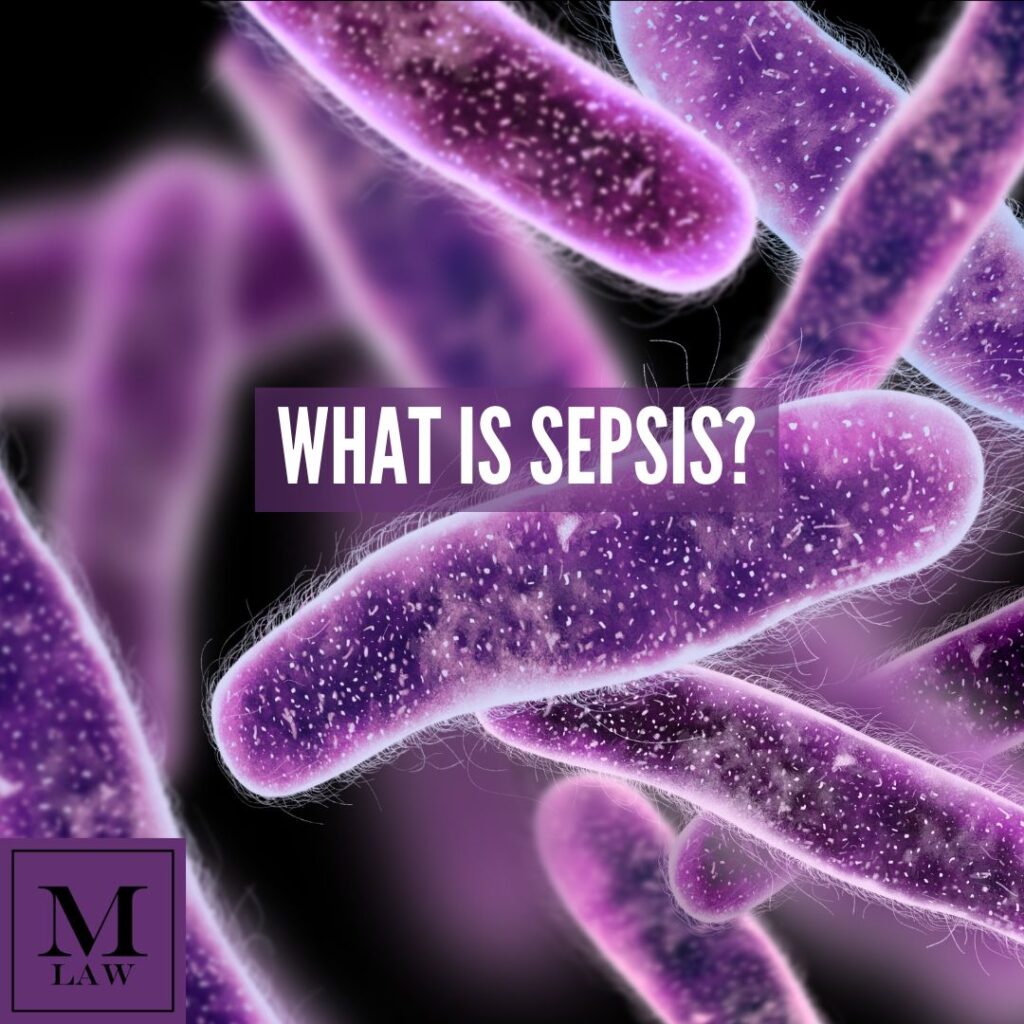 artistic rendering of a sepsis infection