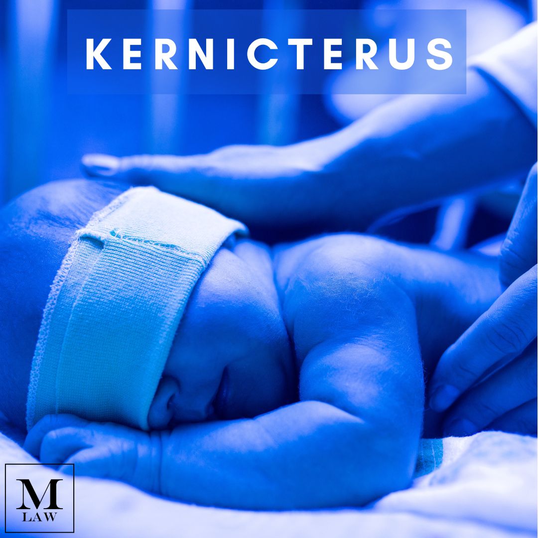 infant receiving phototherapy treatment for kernicterus